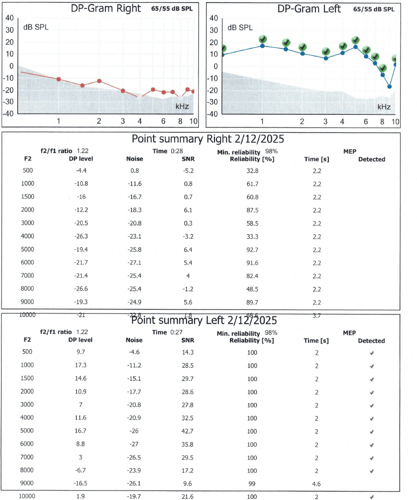  dpoaes case study when a heavy ear isnt just wax   the audiology place