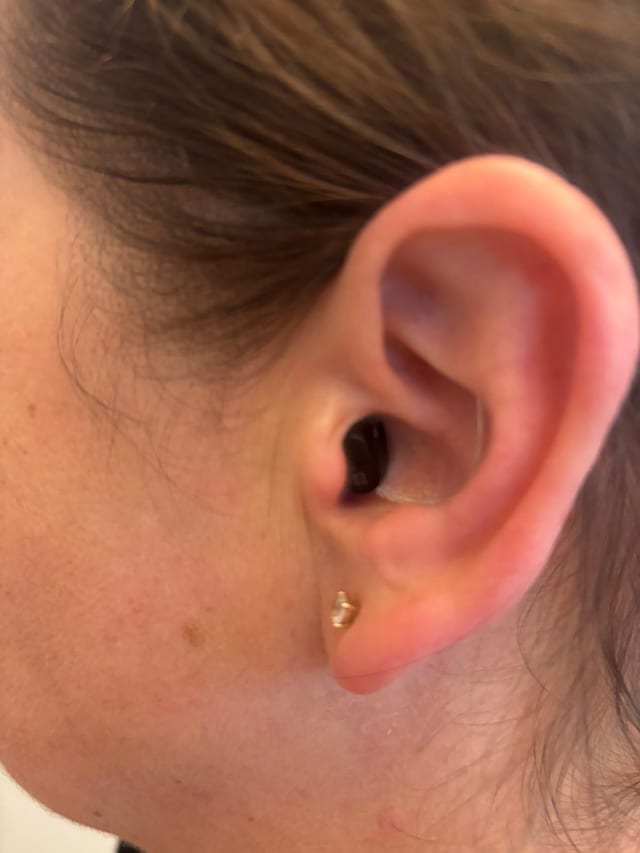 whatsapp image 2026 03 25 at 60659 pm conductive vs sensorineural hearing loss whats the difference the audiology place
