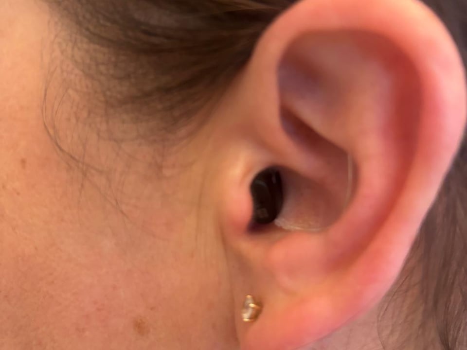 WhatsApp Image 2026-03-25 at 60659 PM - The Audiology Place whatsapp image 2026 03 25 at 60659 pm conductive vs sensorineural hearing loss whats the difference the audiology place