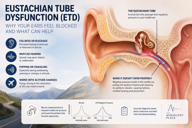 Eustacian Tube - The Audiology Place infographic explaining eustachian tube dysfunction with ear anatomy diagram symptoms list and a cross section of the ear showing the etd pathway and affected areas for relief eustacian tube what is eustachian tube dysfunction the audiology place