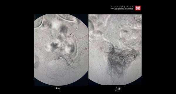 مستشفى الدكتور سليمان الحبيب بالقصيم