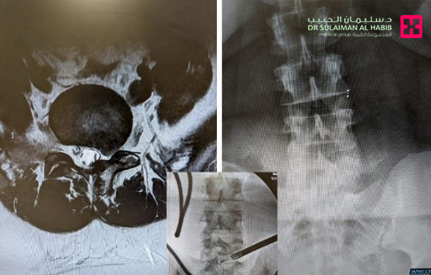 مستشفى الدكتور سليمان الحبيب بالريان