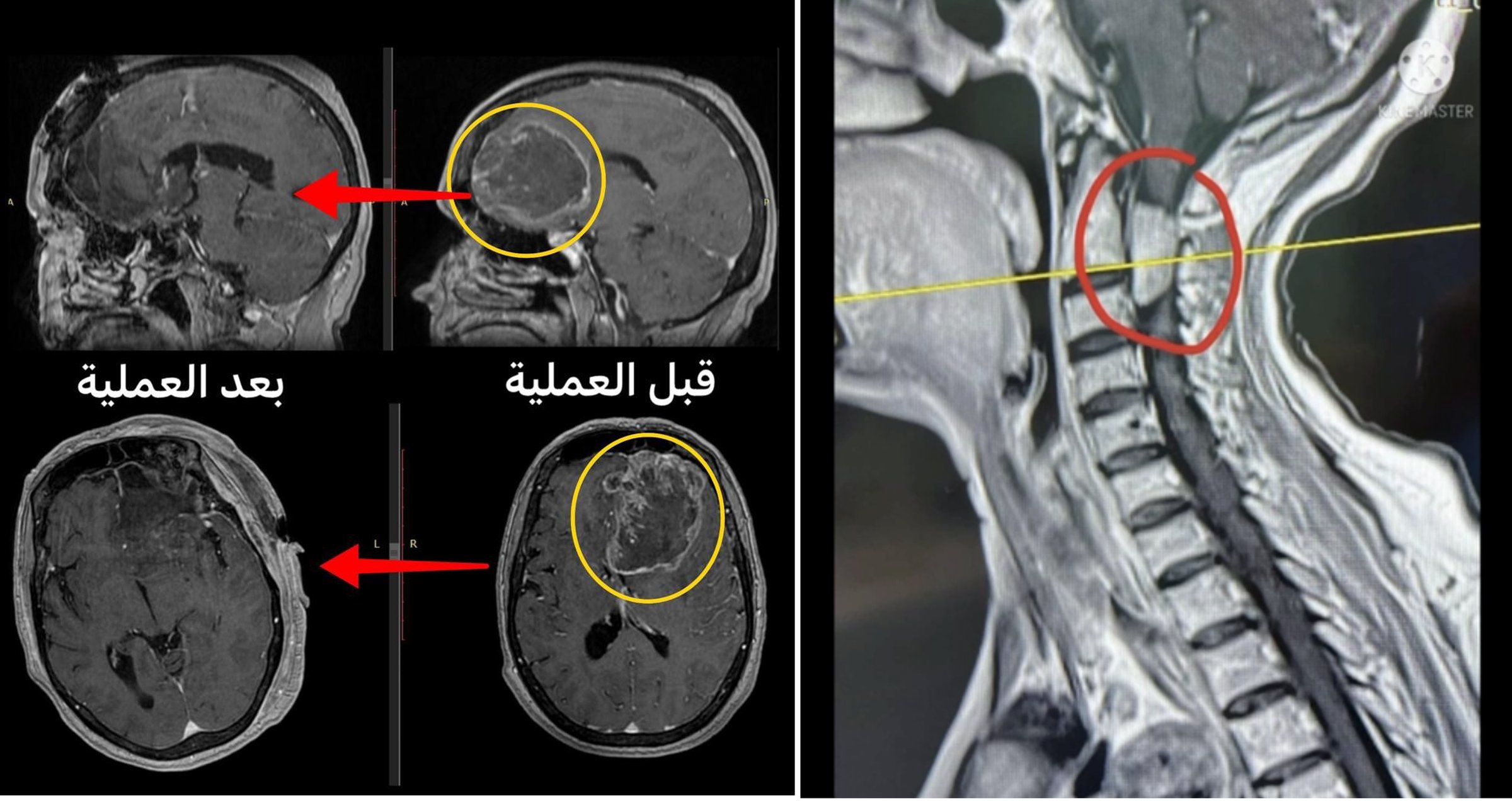 مستشفى الدكتور سليمان الحبيب بالقصيم