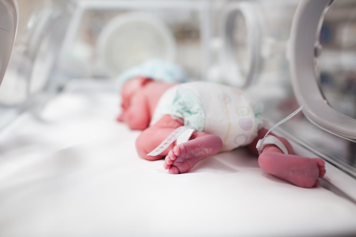 Fotografía de un bebé recién nacido en incubadora, con un pañal desechable y un gorro de color blanco, lleva en ambos pies una cinta de registro.