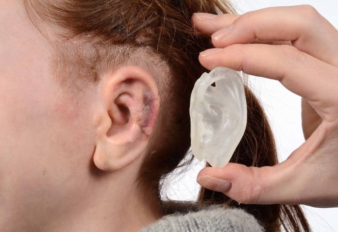 Una oreja de plástico impresa en 3D sobre una oreja normal.