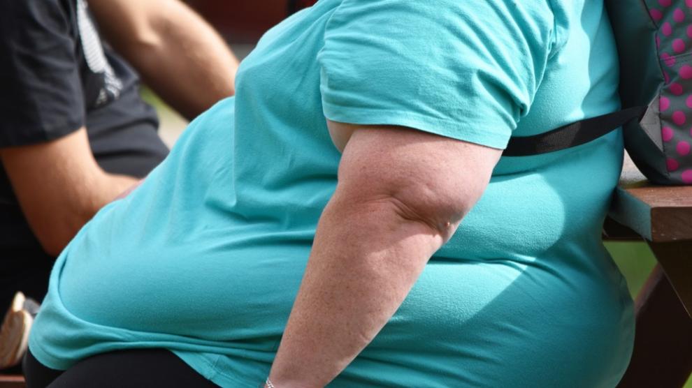 Persona con sobrepeso sentada en la banca de un parque