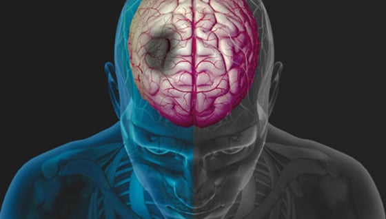 Ilustración del cerebro de una persona