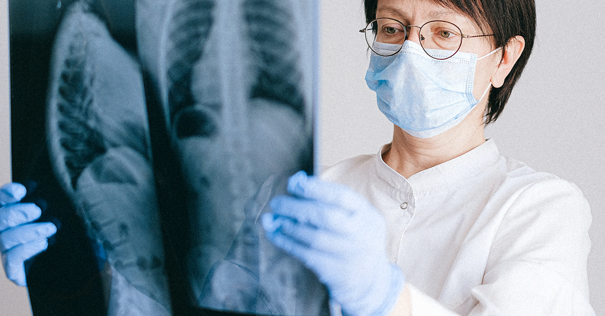 Fotografía de una doctora revisando una placa de rayos x, lleva puesta una bata blanca, lentes, cubrebocas y guantes azules.
