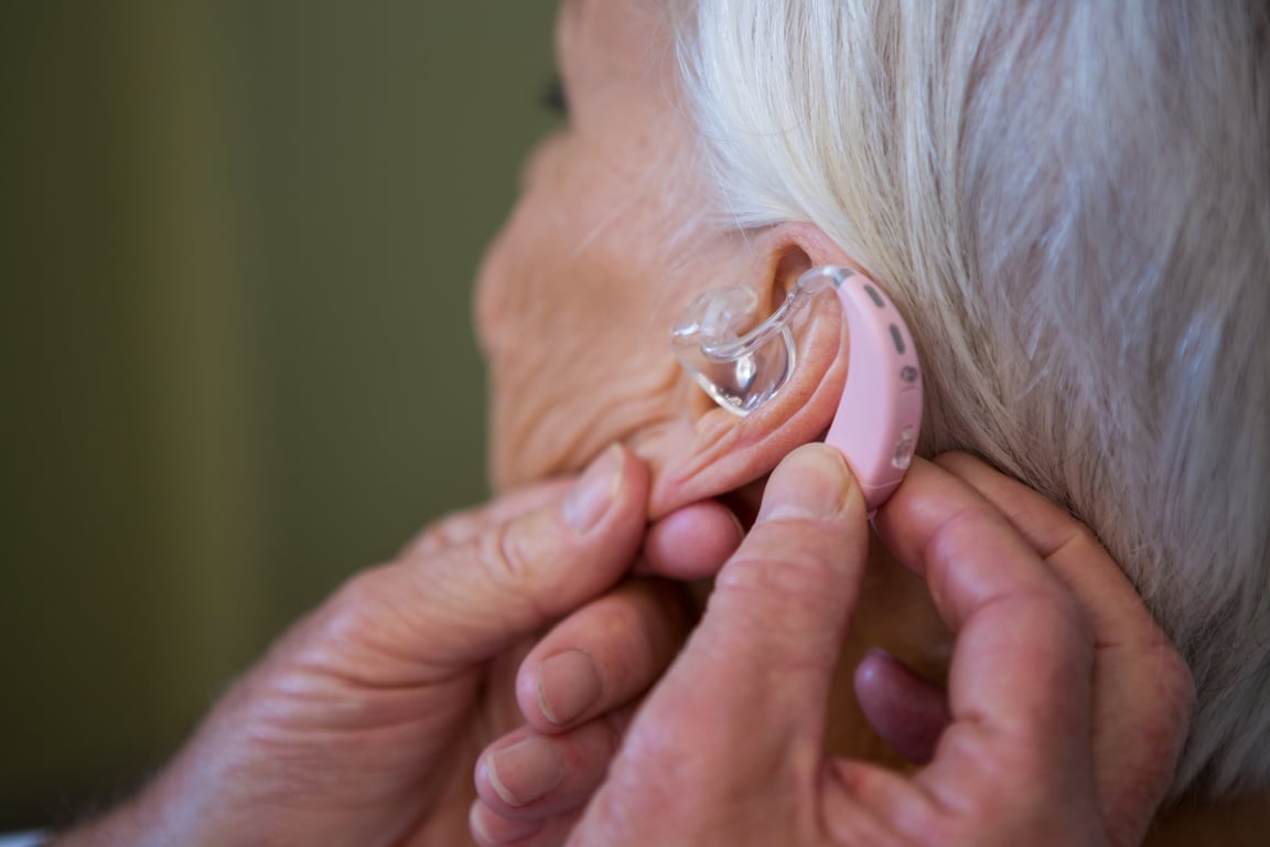 Fotografía en la que se muestra el oído de una mujer mayor de edad con un aparato auditivo en su oído izquierdo.