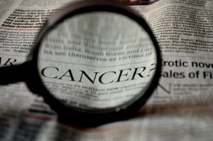 melanoma