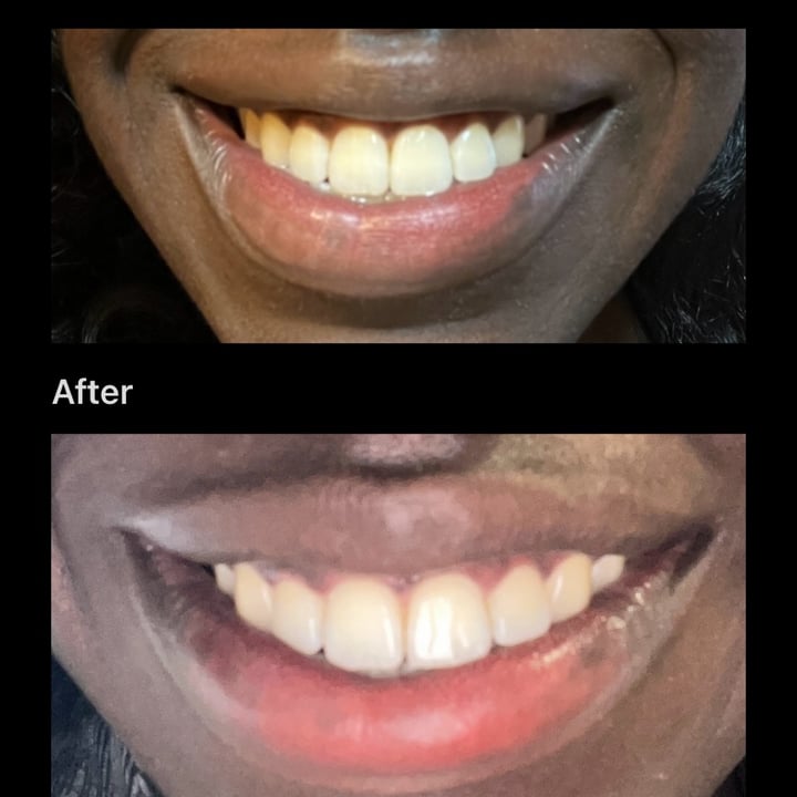 photo of Spotlight Oral Care W Teeth Whitening Strips shared by @fran-ban on  26 Apr 2024 - review