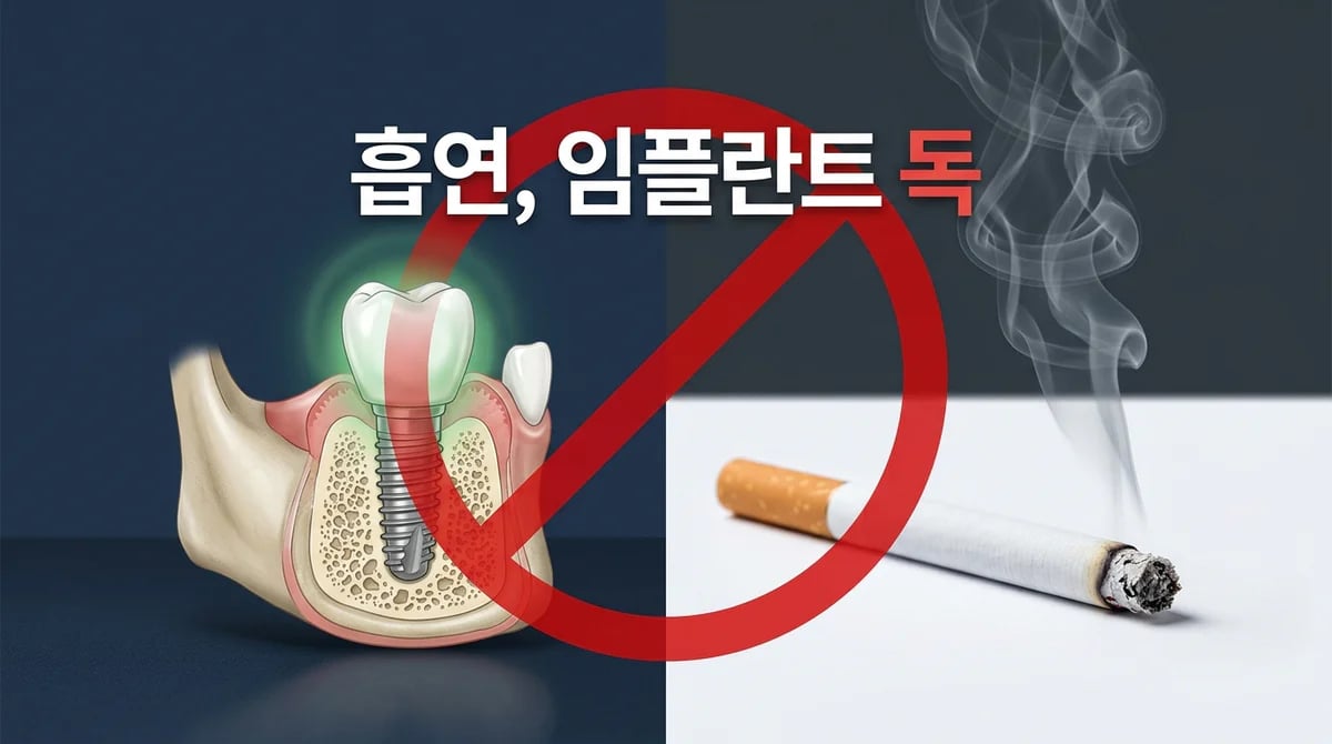 임플란트 수술 후 흡연: 성공적 회복을 위한 과학적 주의사항 5가지