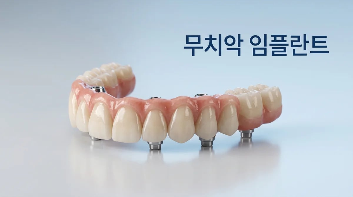 전체 치아 상실 임플란트 치료 과정: 무치악 상태 극복을 위한 단계별 가이드