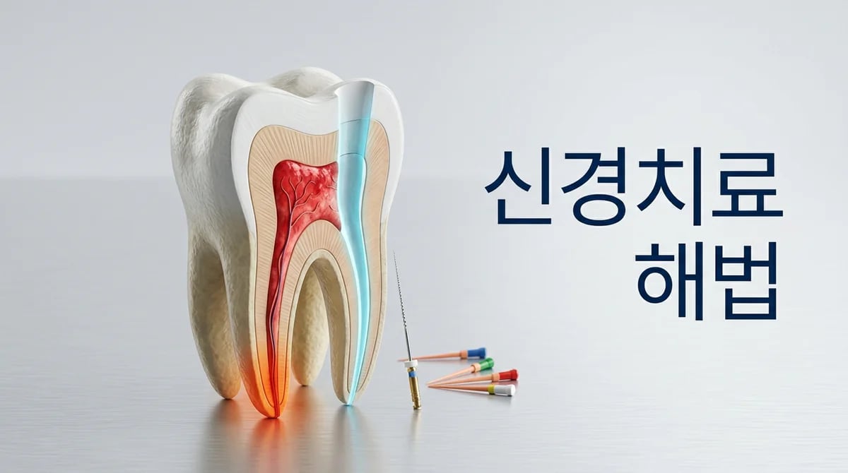 신경치료 방법과 사용 재료 4가지: 치과 보존 치료 완벽 가이드