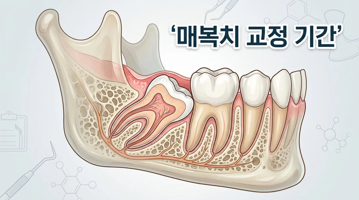 누워있는 매복 어금니 교정: 치료 기간과 영향을 미치는 4가지 핵심 요소