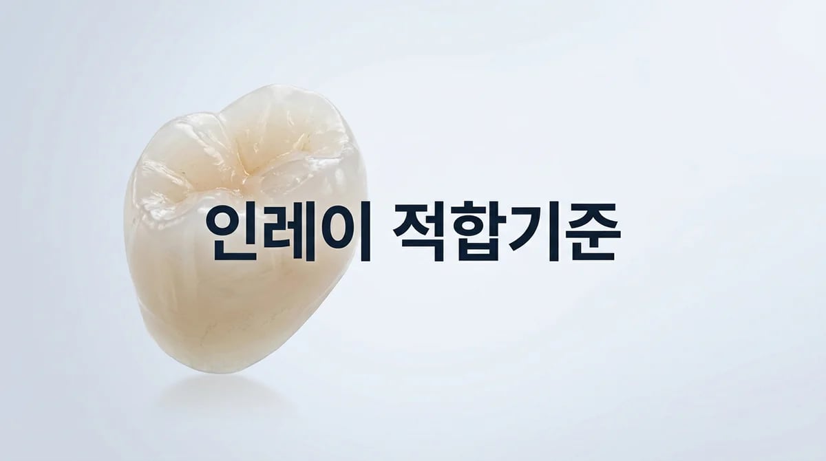 이맥스 인레이 적합성: 충치 면적 아닌 '기능교두' 보존이 핵심