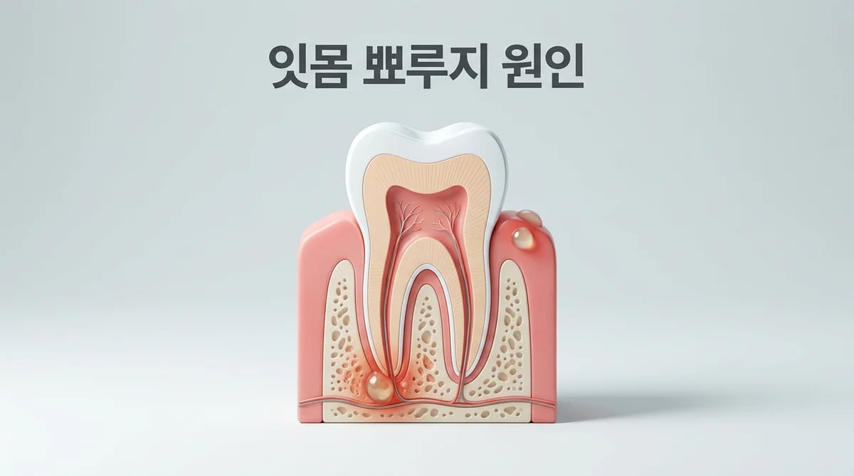 잇몸 뾰루지: 고름의 정체와 3가지 주요 원인, 안전한 대처법