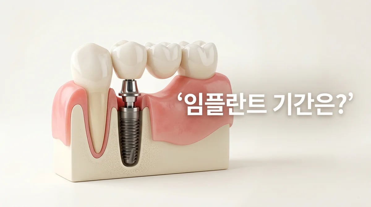 앞니 임플란트 브릿지: 치료 과정과 기간, 성공적인 결과를 위한 가이드