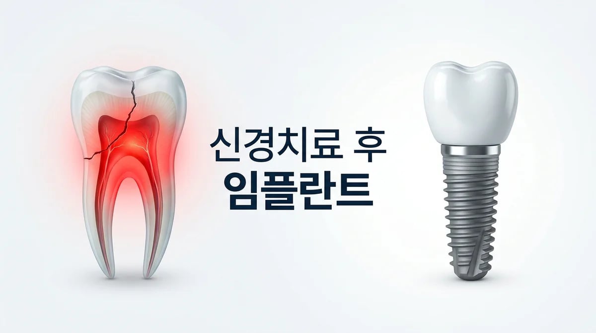 신경치료 후에도 통증? 발치와 임플란트 고려 5가지 핵심 가이드