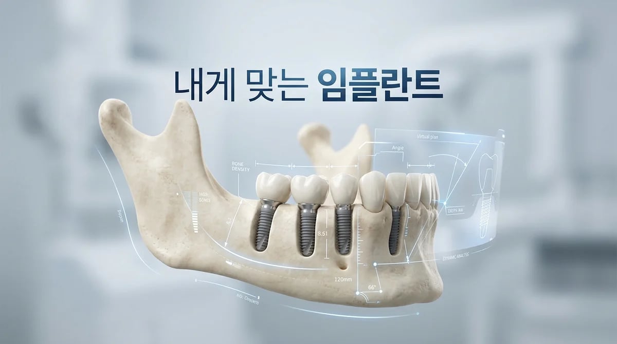 임플란트 수술: 정밀 진단부터 즉시/지연 식립까지, 나에게 맞는 선택 기준