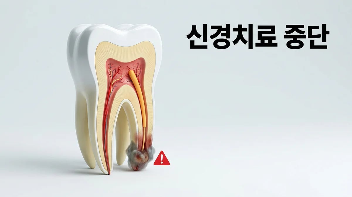 신경치료 중단, 통증 사라져도 방치하면 더 큰 문제 3가지