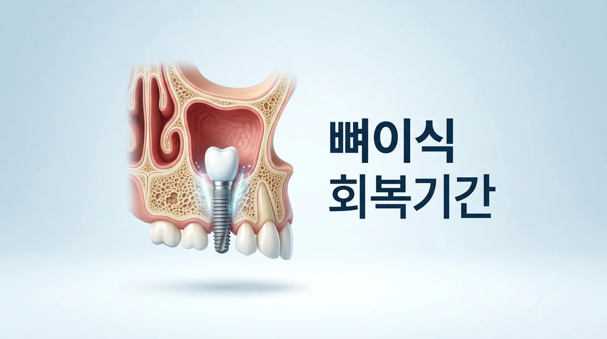 상악동 뼈이식과 임플란트 성공: 회복 기간 및 뼈 생성 과정 이해