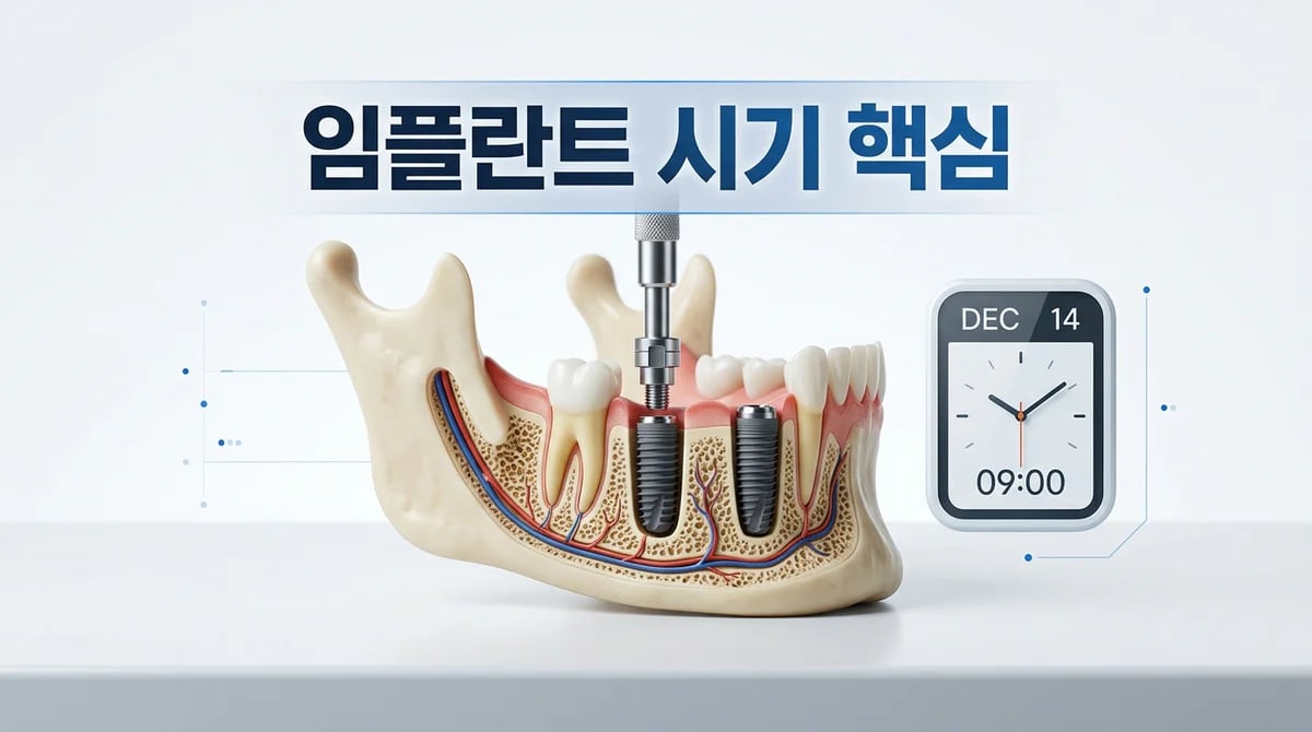발치 후 임플란트, 성공적인 식립 시기를 결정하는 4가지 핵심 원칙