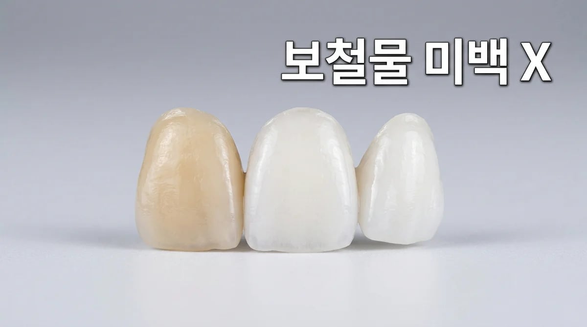 앞니 보철물, 치아 미백 효과가 없는 명확한 이유와 해결책