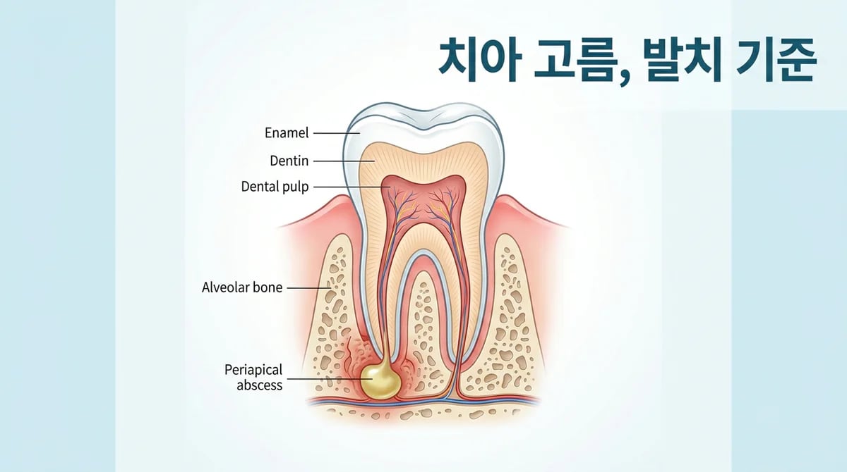 치아 고름(농양), 왜 생길까? 발치 전 필수 정보와 원인 분석