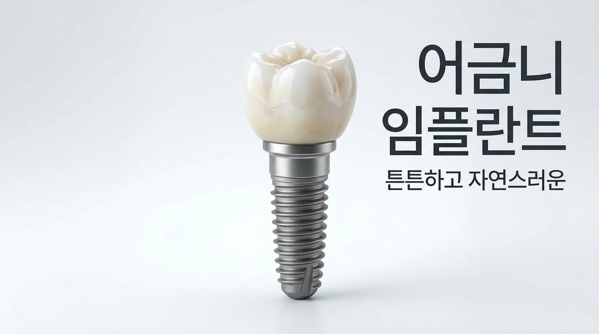 어금니 임플란트 강도와 내구성: 강력한 저작력을 견디는 비결