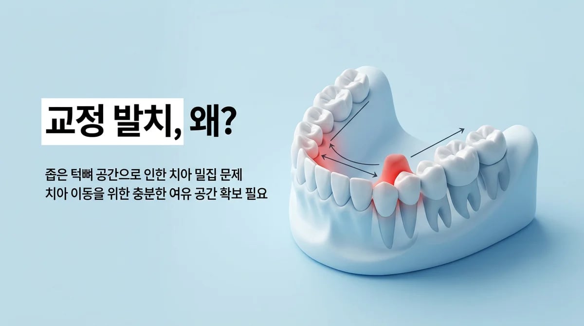 치아 교정 시 발치, 왜 필요할까? 일반적인 3가지 경우와 진단 기준