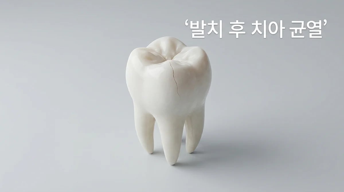 발치 후 인접 치아 균열: 2가지 주요 원인과 증상 분석