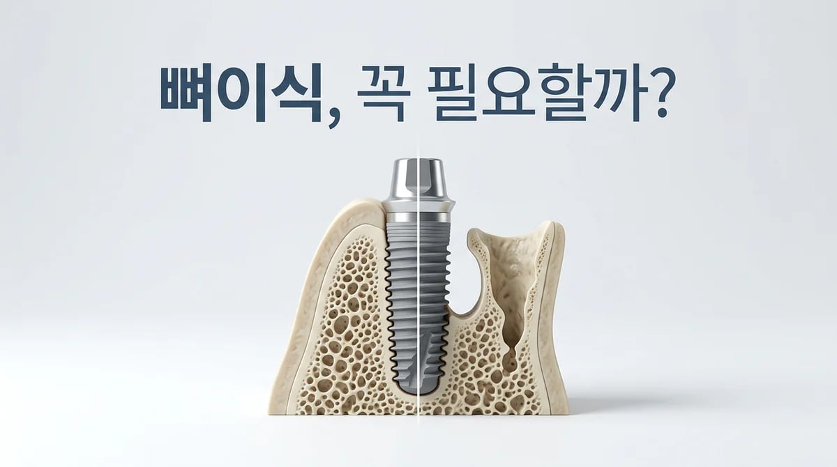 임플란트 뼈이식, 언제 필수적일까요? 3D-CT 진단 기준 완벽 분석
