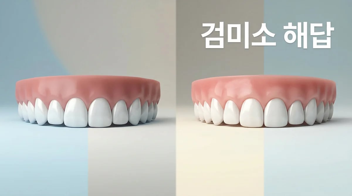 웃을 때 잇몸 보이는 검미소: 원인과 개선 방법 4가지 분석