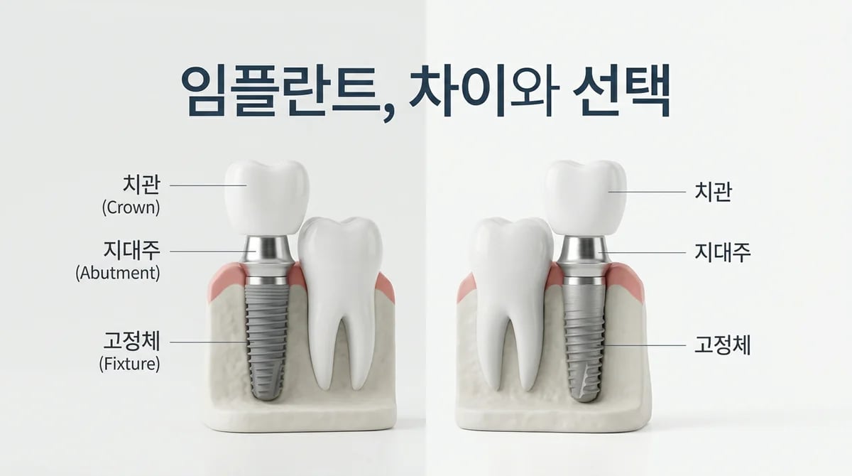 외산 임플란트, 국산과 어떤 차이? 가격 이해와 합리적 선택 가이드