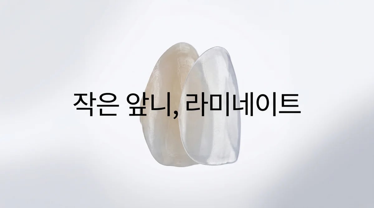 선천적 작은 치아(왜소치) 라미네이트로 심미성 개선 방법과 최소삭제 원리