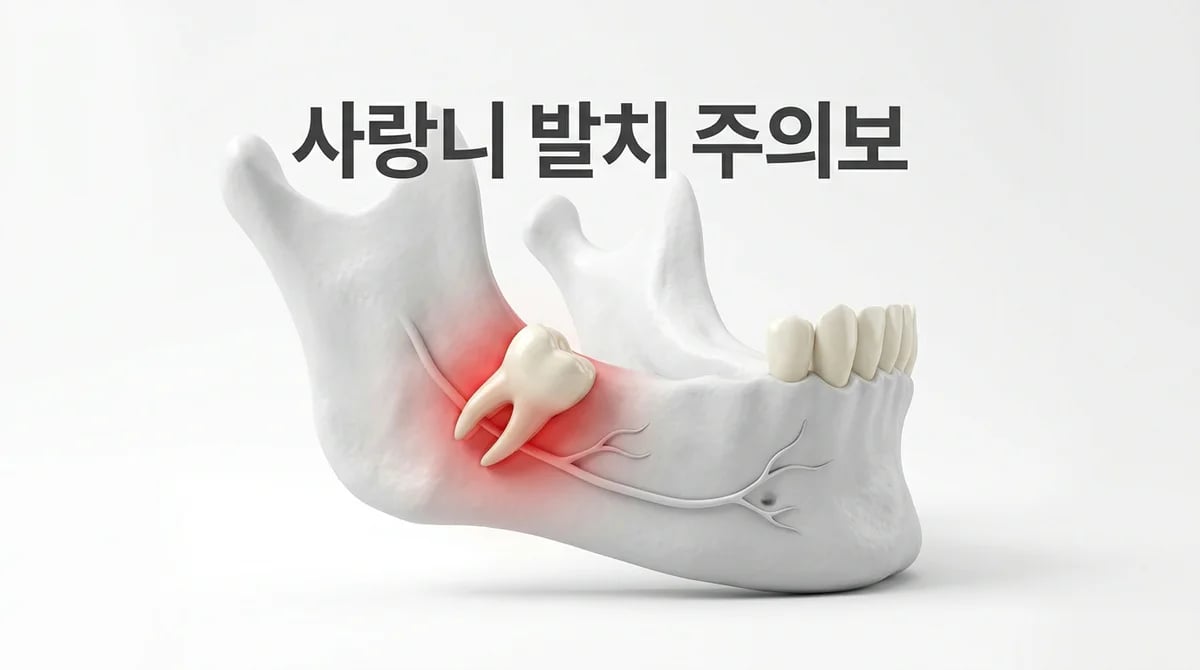 매복 사랑니 발치 전 필수 확인! 신경 손상 위험과 주의사항