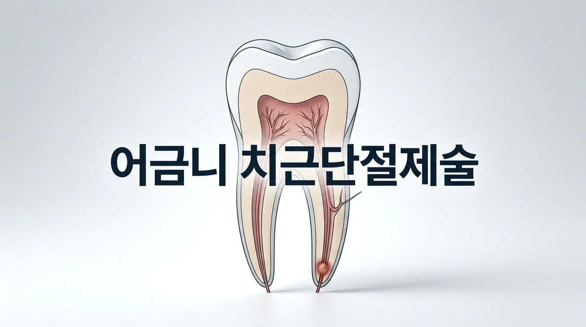 어금니 치근단절제술, 어떤 경우에 필요할까? 5가지 핵심 정보