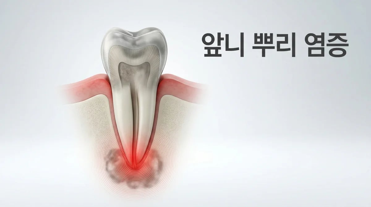앞니 뿌리 염증: 숨겨진 원인, 주요 증상, 그리고 올바른 치료법