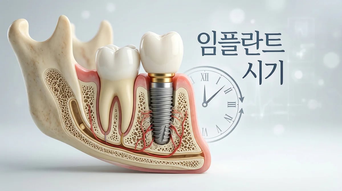 앞니 임플란트 식립 시기 결정: 잇몸뼈 변화와 최적의 선택