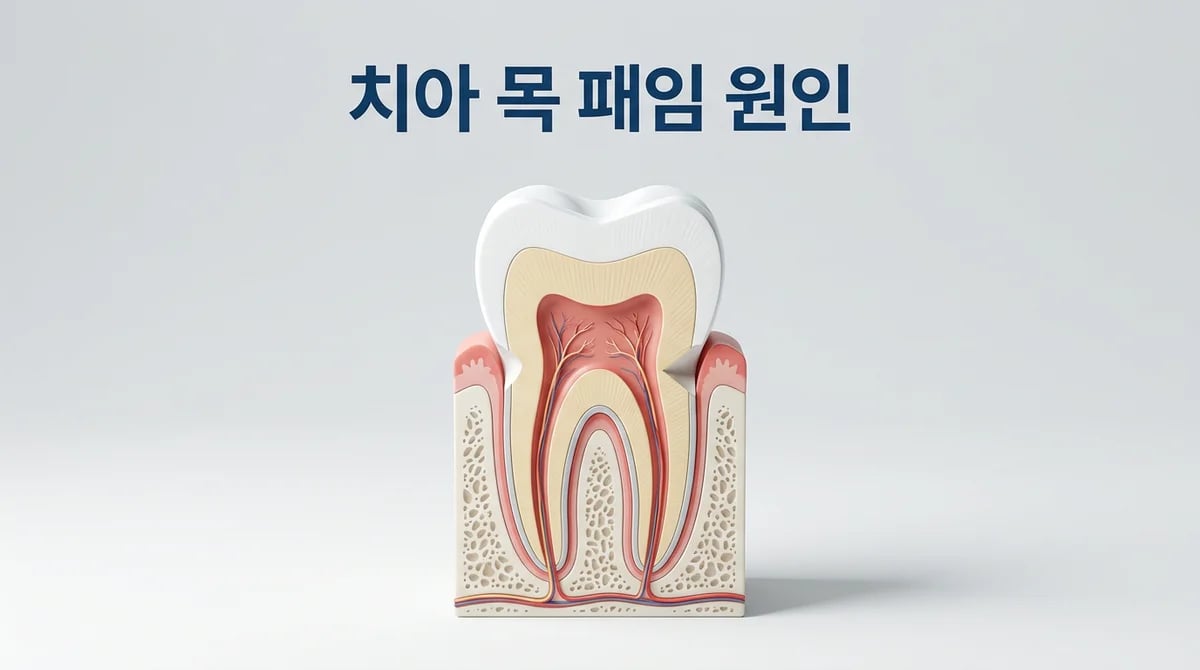 치경부마모증 오해와 진실: 일반적인 발생 원인 3가지 분석