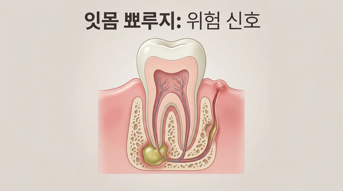 잇몸 뾰루지: 단순 염증 아닌 신호? 원인과 현명한 대처법