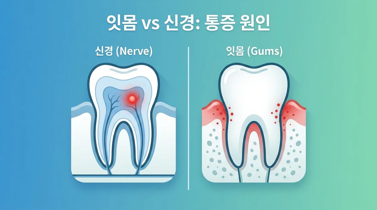 잇몸수술과 신경치료: 증상, 원인, 근본적 차이점 완벽 가이드