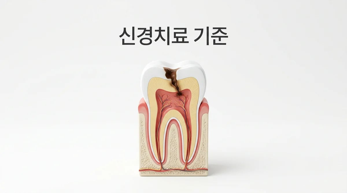 충치 깊이와 통증: 언제 신경치료가 필요할까요? 치의학적 판단 기준