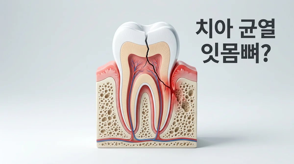 치아 파절, 잇몸뼈 손상으로 이어질 수 있을까? 원인과 진단