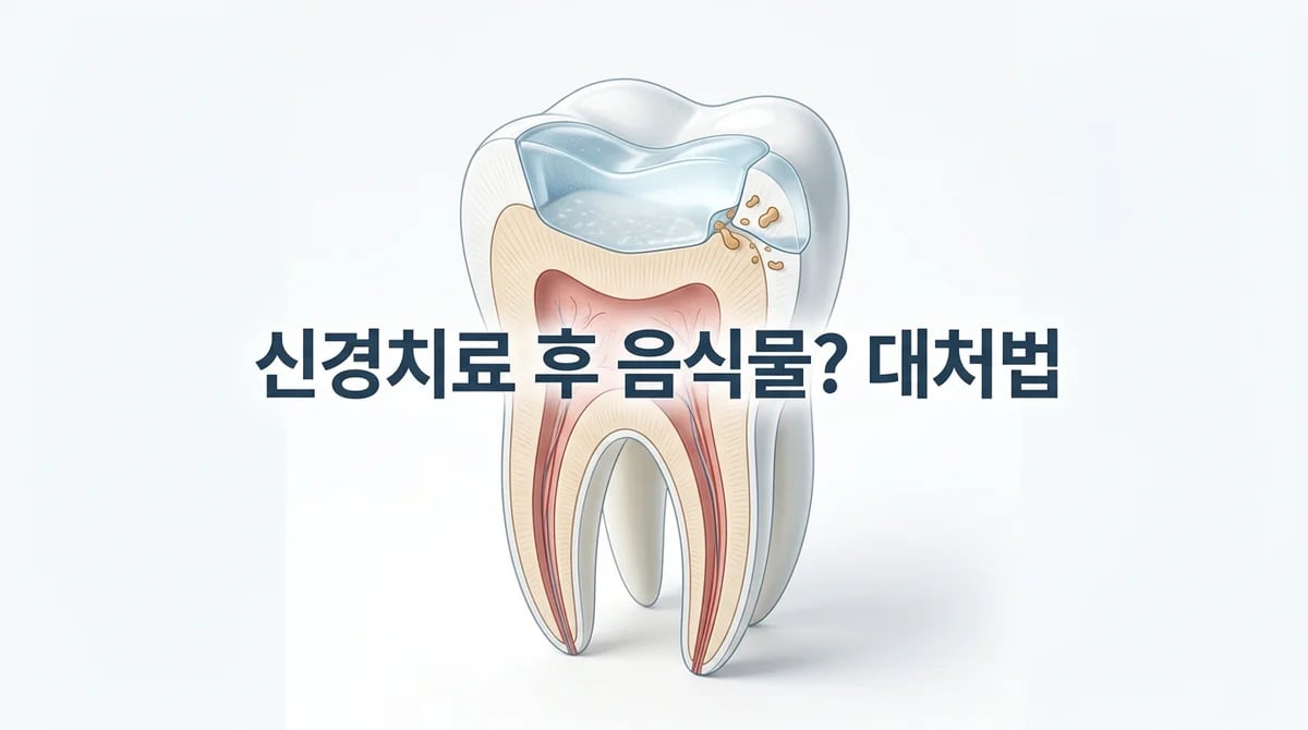 신경치료 중 치아에 음식물 끼임, 왜? 올바른 관리 및 대처 가이드