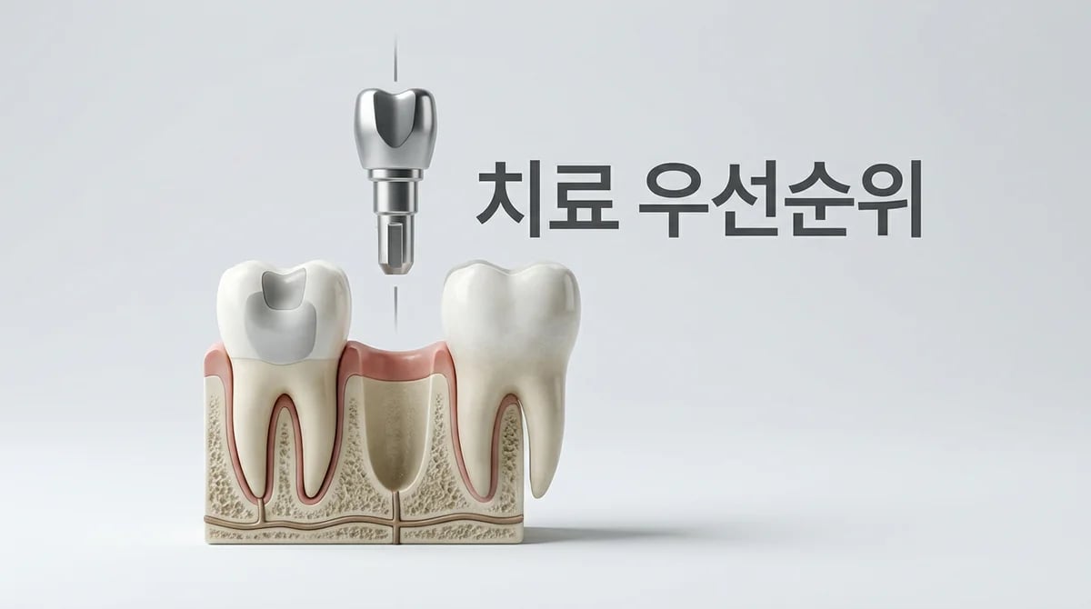 성공적인 임플란트를 위한 충치·잇몸 치료 우선순위 결정 가이드