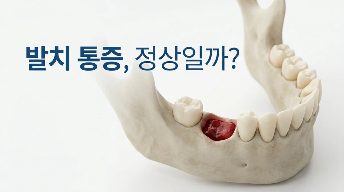 발치 후 잇몸 통증: 시기별 원인 분석과 올바른 관리법