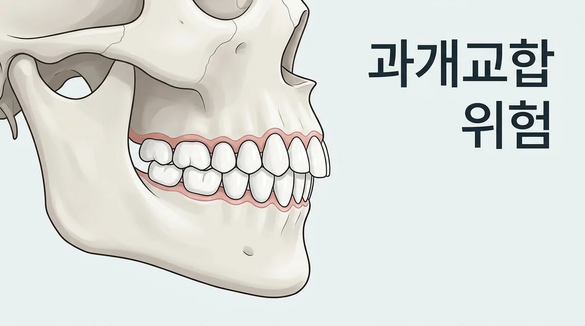 과개교합 방치하면? 연쇄적으로 발생하는 구강 문제와 턱관절 통증