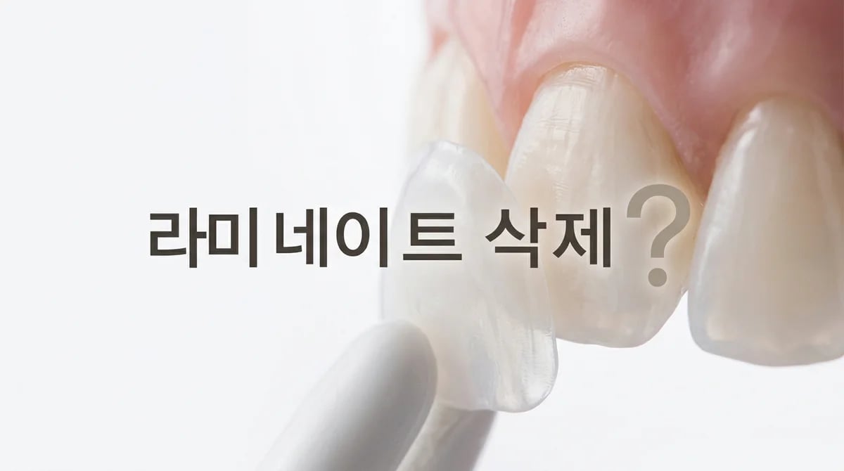 라미네이트 치아 삭제, 과연 필수일까? 무삭제 가능성 3가지 분석